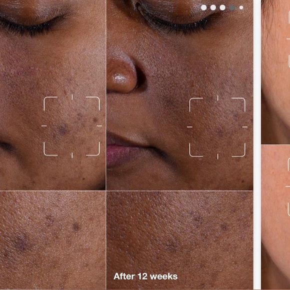 New Clinique Even Better Clinical Serum - Picture 5 of 8